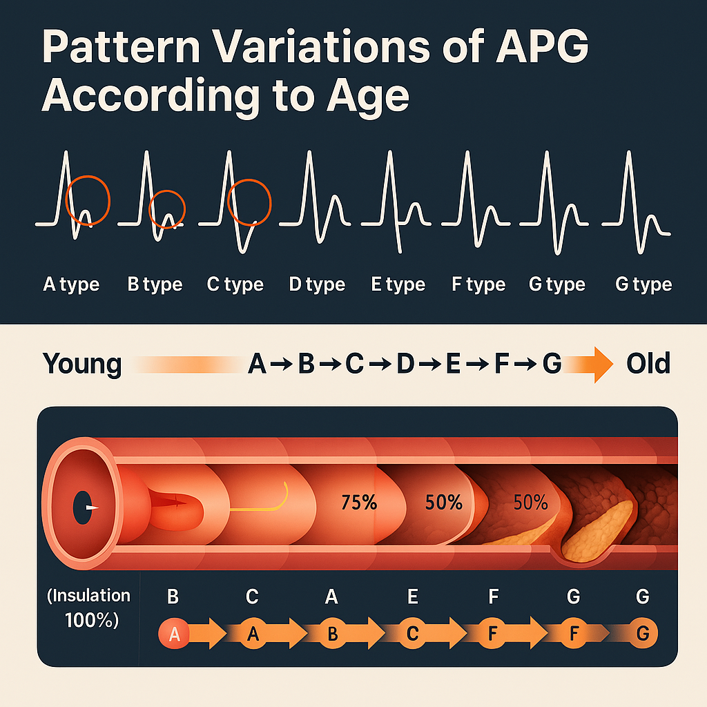 กราฟฟิก Vascular Age Index (VAI) หรือ ดัชนีอายุหลอดเลือด กราฟฟิก Vascular Age Index (VAI) หรือ ดัชนีอายุหลอดเลือด