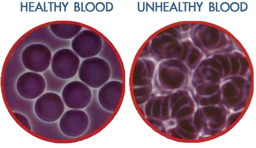ผลเลือด live blood analysis ดีและไม่ดี ผลเลือด live blood analysis ดีและไม่ดี